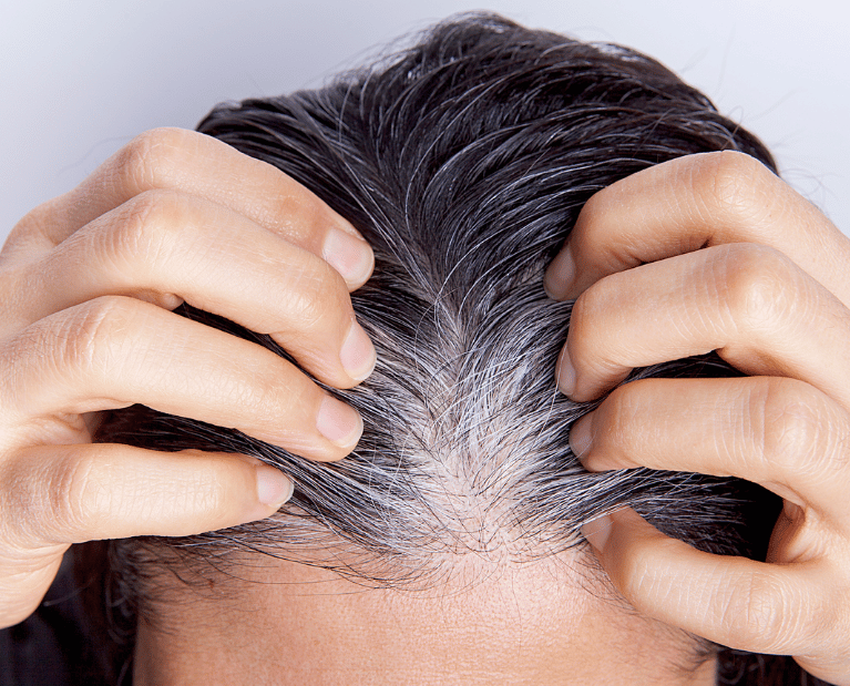 hair concern category, hair loss